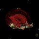 Hemocephalus, ventricular bleeding: CT - Computed tomography